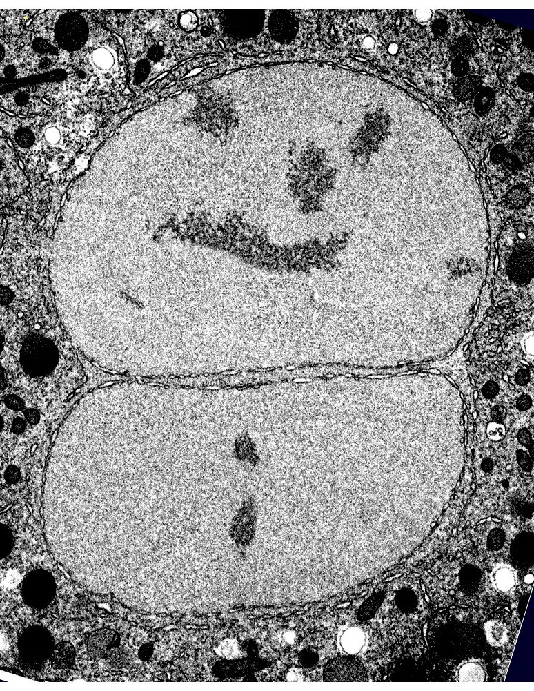 A 'smiling' 1-cell C. Elegans embryo.