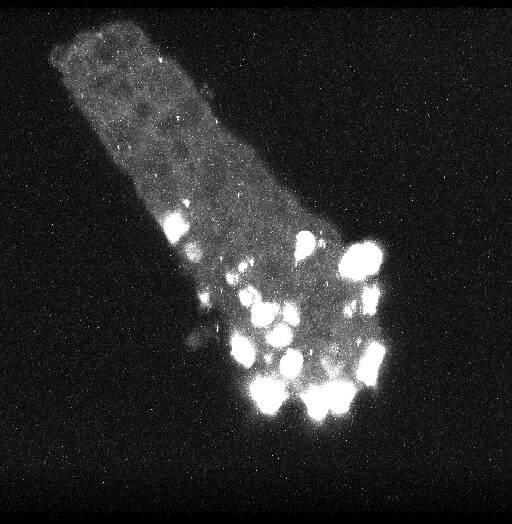 Confocal 3D analysis of ACEC following chromogranin A staining.