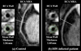Image of non-invasive imaging