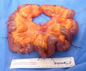 Image of small intestine