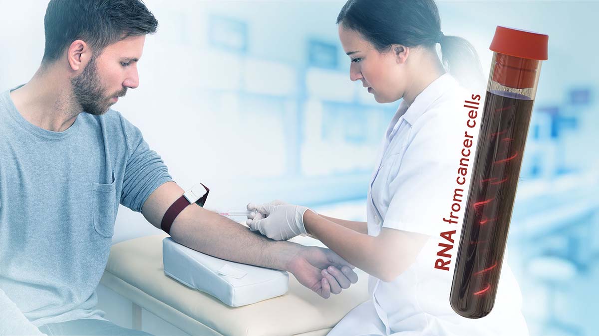 A nurse draws blood from the arm of a patient. To the side, RNA floats in a vial of blood. The vial is labeled RNA from cancer cells.
