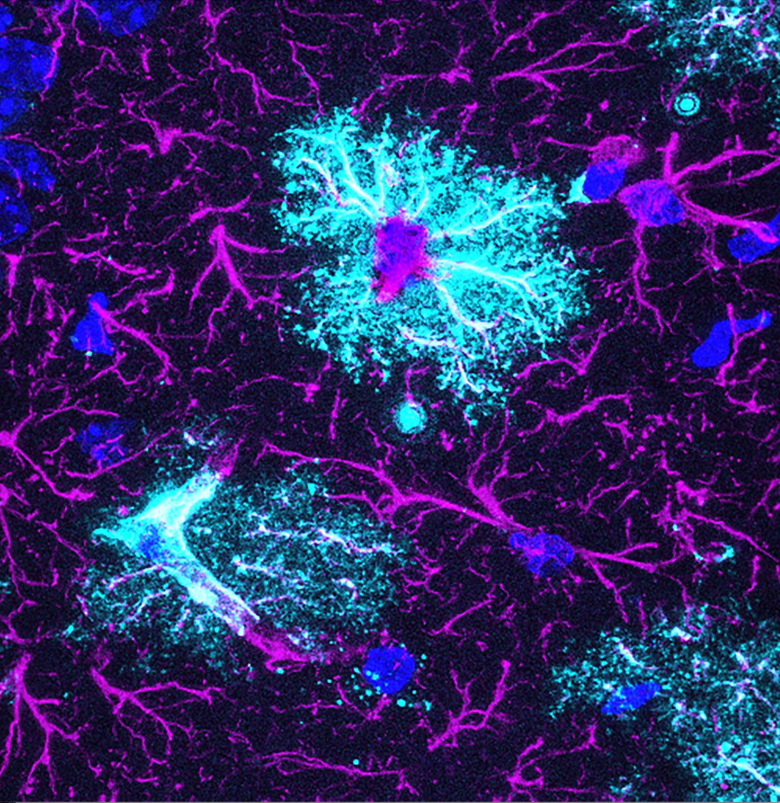 An astrocyte expressing type 2 deiodinase, a thyroid hormone-amplifying enzyme essential for brain development. 