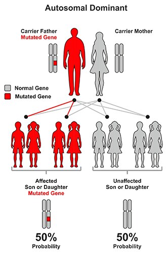 Illustration of autosomal dominant pattern. Children of a parent with the disease gene have a 50% chance of not having the disease, and a 50% chance of having the disease.