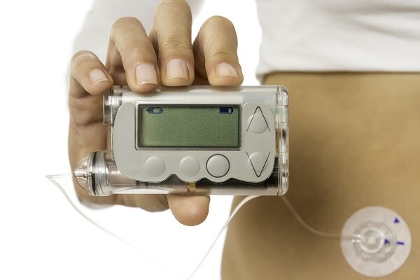 A woman holds an insulin pump with the tube connected to a patch on her stomach, where the needle is inserted.