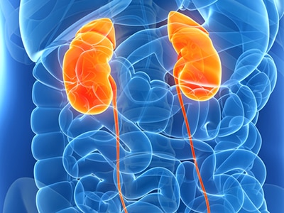 Kidney Disease organ diagram