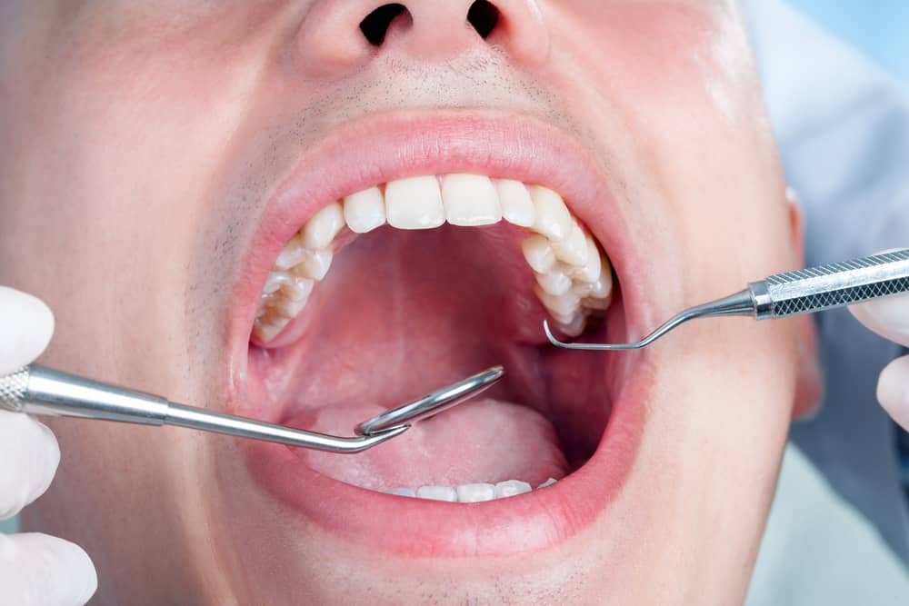 Una persona en una limpieza dental con instrumentos dentales dentro de una boca abierta.