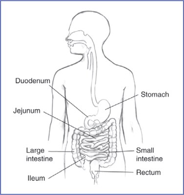 Drawing of the digestive tract within an outline of the top half of a human body. The stomach, duodenum, jejunum, ileum, small