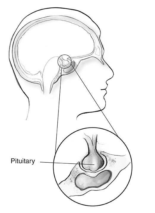 Cross-section of a human head with an inset showing the pituitary gland.