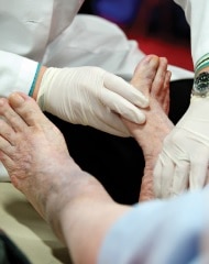 Un médico examina los pies de una persona.
