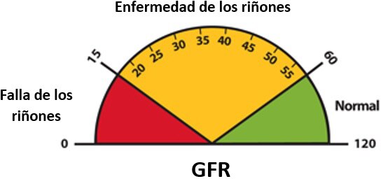 Diagrama de un disco de TFG que muestra cómo una TFG de 60 o mayor es normal; una TFG por debajo de 60 puede significar enfermedad de los riñones y una TFG de 15 o menos puede significar la falla de los riñones.