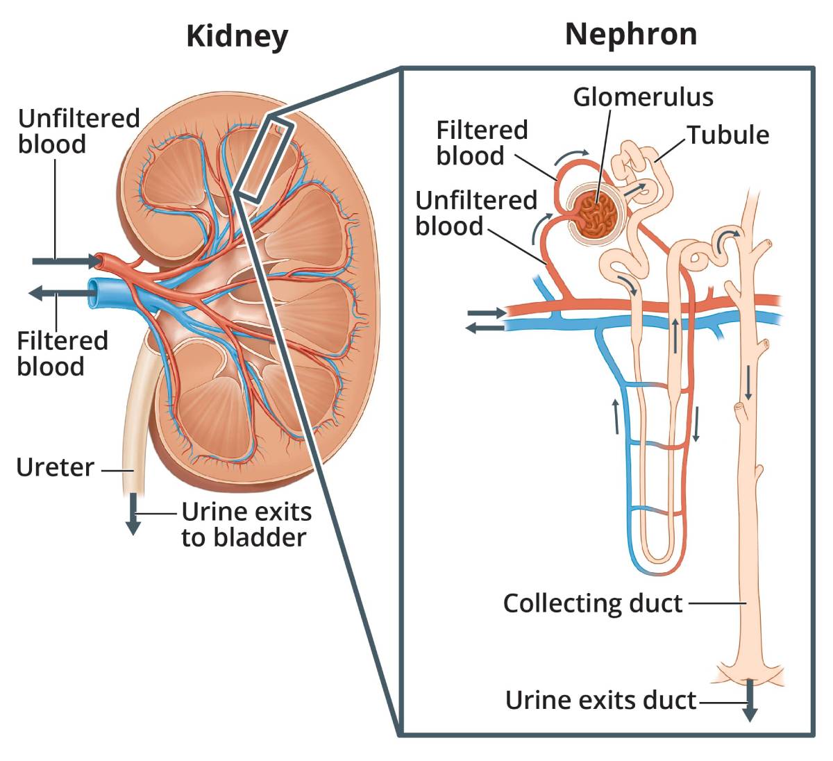 Alt-text: Two illustrations. A human kidney, with arrows showing where unfiltered blood enters the kidney and filtered blood leaves the kidney. Wastes and extra water leave the kidney through the ureter to the bladder as urine. An inset image shows a microscopic view of a nephron, one of the tiny units in the kidney that filters the blood. Arrows show the path unfiltered blood takes into the glomerulus, which filters it. Arrows also show how waste leaves the glomerulus via the tubule, which takes it to the collecting duct. The collecting duct collects the extra waste and water that leave the body as urine. Labels point to the unfiltered blood, filtered blood, glomerulus, tubule, and collecting duct