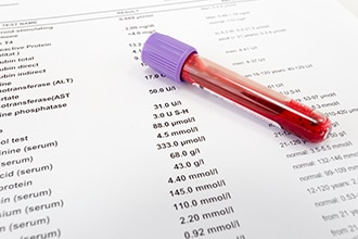 Tubo de ensayo con sangre sobre un papel con resultados de la prueba.
