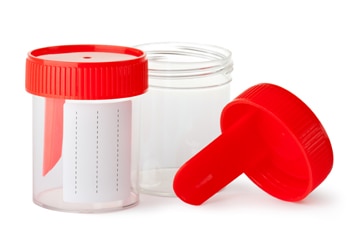 Small, empty plastic jars, with lids, that are used for urine samples.
