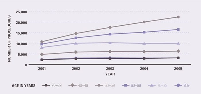 The growth in colonoscopy from 2001–2005 was concentrated among persons aged 50-59 years and to a lesser extent, among 60–69 year olds. The number of colonoscopies among other age groups changed little. The number of colonoscopies increased between 2001 and 2005 as follows: among 50-59 year olds, from 10,695 to 22,342; among 60-69 year olds, from 9,581 to 16,472; among 70-79 year olds, from 8,015 to 9,984; among 40-49 year olds, from 4,729 to 6,276; among 80+ year olds, from 2,315 to 3,135; and among 20-39 year olds, from 2,175 to 3,092.
