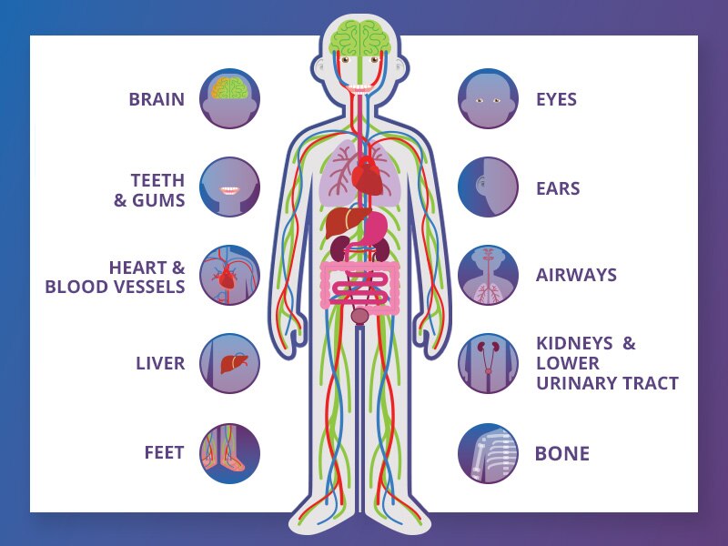 Diagram of body parts and organs that can be affected by diabetes