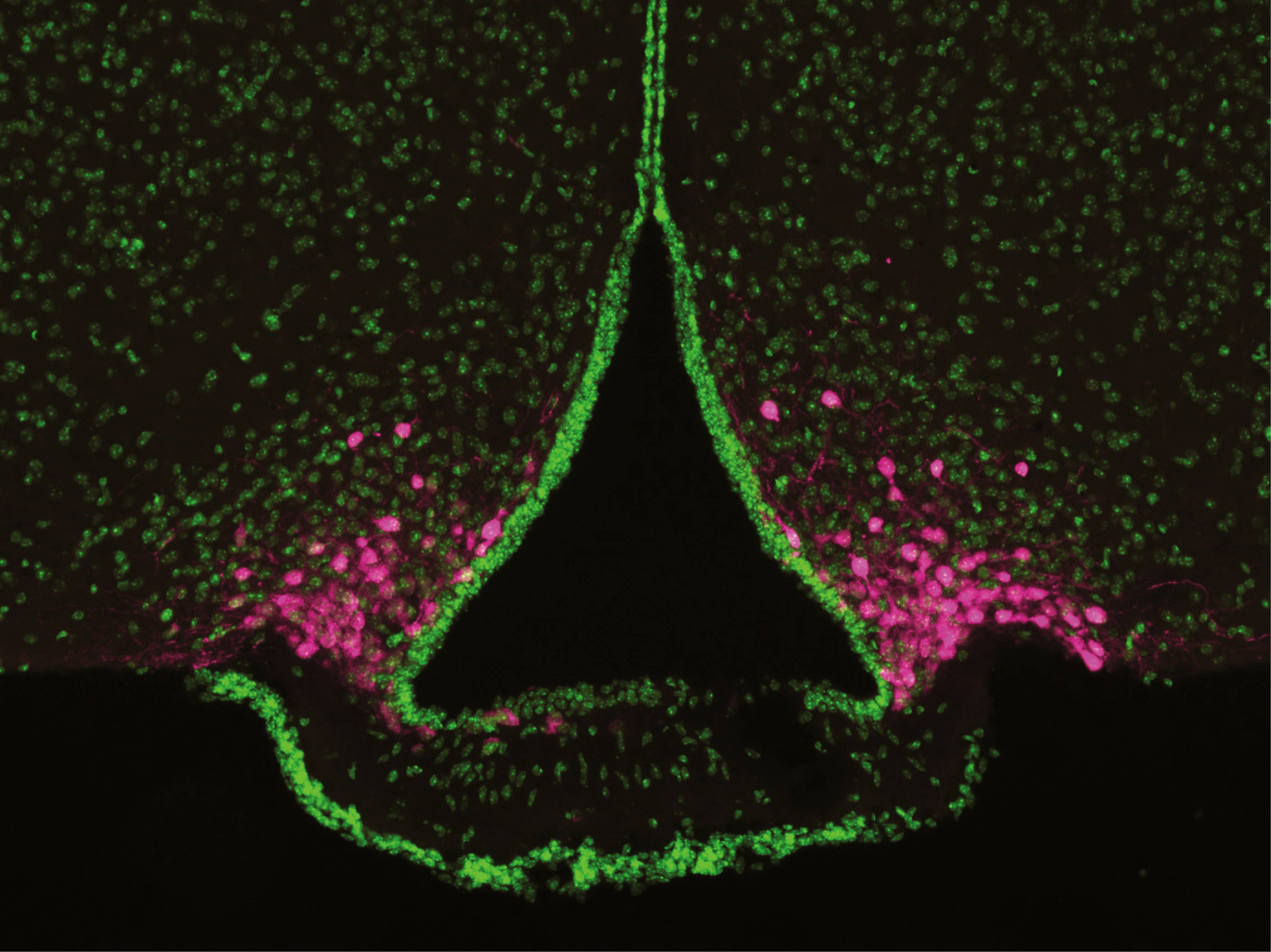 Photo of AgRP neurons of the arcuate nucleus