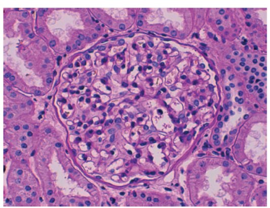 Glomerular capillary loops.