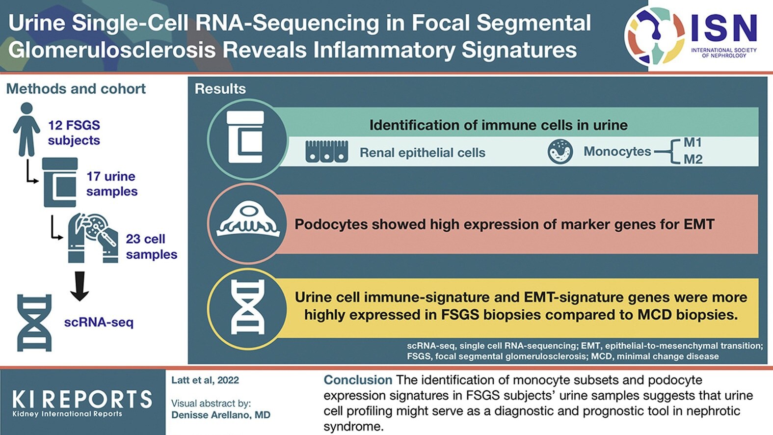 Urine single-cell RNA-sequencing in focal segmental glomerulosclerosis reveals inflammatory signatures 