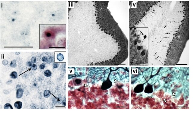 Photo of Fragile X premutation mice show neurodegeneration similar to humans with Fragile X-associated tremor and ataxia syndrome