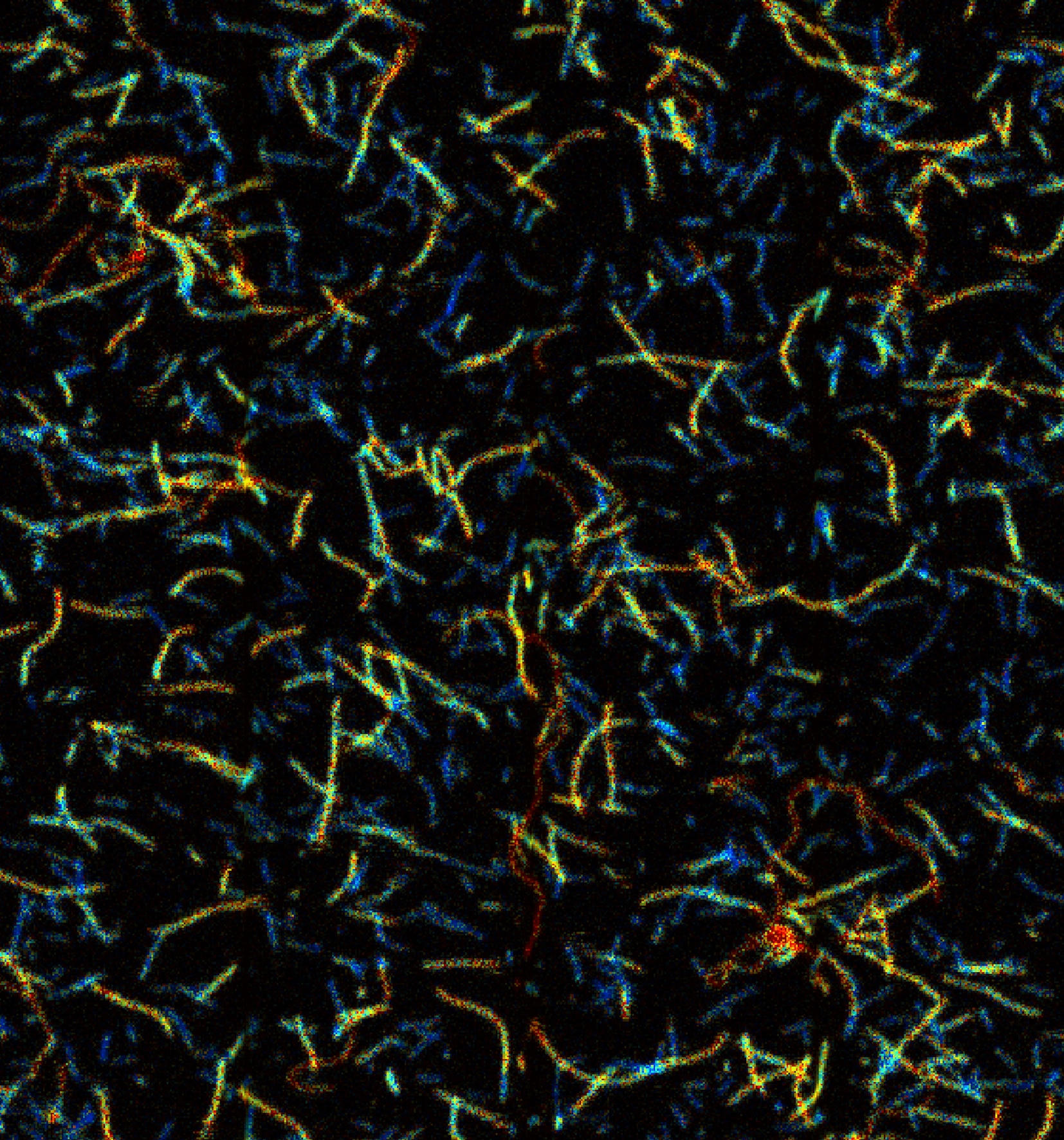 Heterogeneous amyloid beta fibril formation probed by fluorescence lifetime imaging.